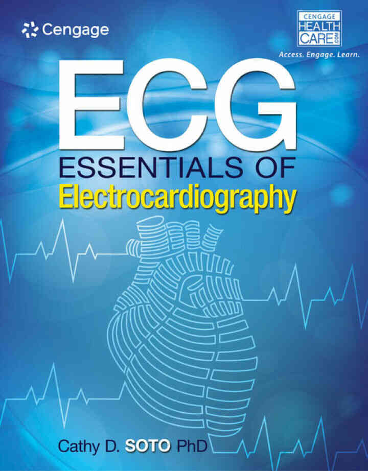ECG: Essentials of Electrocardiography 1st Edition
